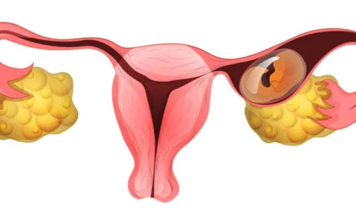 مين جربت أعراض الحمل خارج الرحم ؟