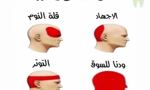 اماكن الصداع بالراس
