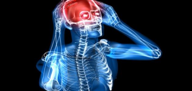 صداع الأورام وما هي أعراض مرض سرطان الرأس؟