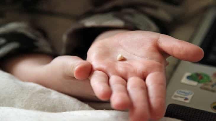 أهم 7 تأويلات رؤية سقوط السن في المنام لابن سيرين تعرف عليهم بالتفصيل