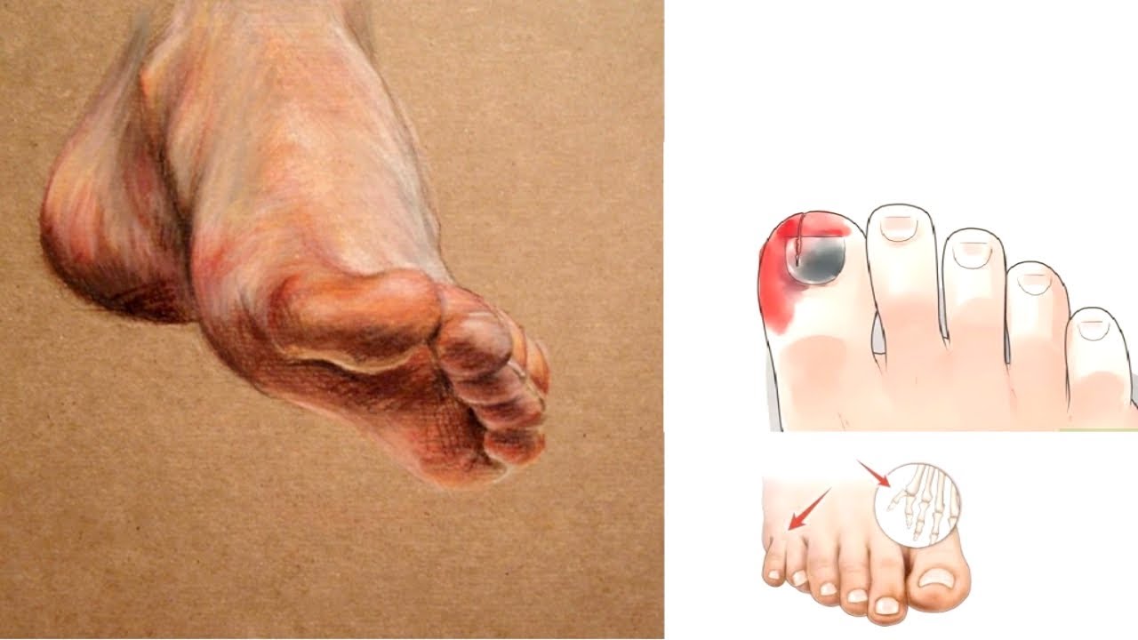 ما هو تفسير حلم الجرح المفتوح بدون دم في القدم لابن سيرين